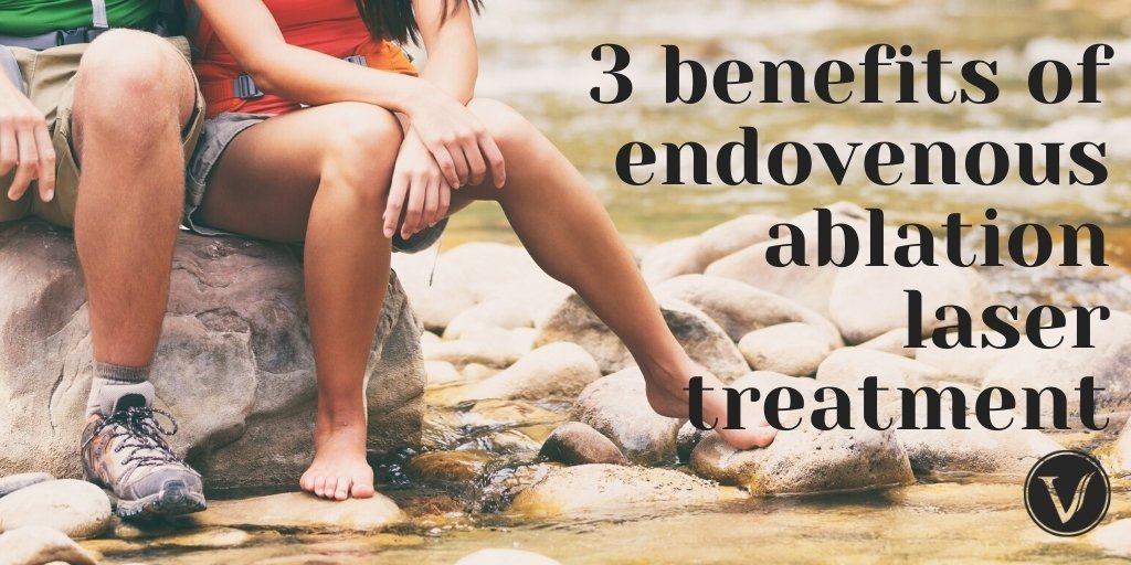 3 Benefits of Endovenous Ablation Laser Treatment