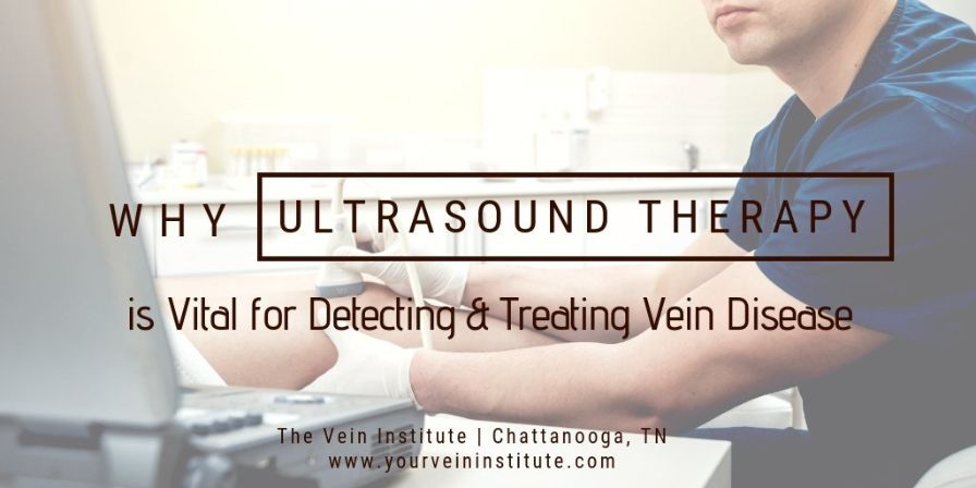 Why Ultrasound Therapy is Vital for Detecting & Treating Veins